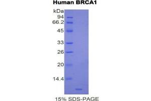 Image no. 1 for Breast Cancer 1 (BRCA1) (AA 19-83) protein (His tag) (ABIN1877581)