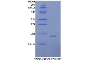 Image no. 5 for Annexin A4 (ANXA4) ELISA Kit (ABIN6720590)