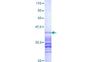 Image no. 1 for RAB5B, Member RAS Oncogene Family (RAB5B) (AA 116-215) protein (GST tag) (ABIN1317183)