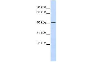Image no. 1 for anti-Carboxypeptidase B2 (Plasma) (CPB2) (Middle Region) antibody (ABIN2781326)