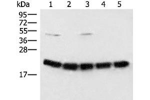 Western blot analysis of Raji cell Mouse brain tissue Hela A375 and 231 cell lysates using ARF5 Polyclonal Antibody at dilution of 1:400