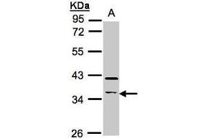 Image no. 3 for anti-Ras Association (RalGDS/AF-6) Domain Family Member 2 (RASSF2) (Center) antibody (ABIN2856502)