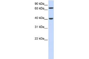 Image no. 1 for anti-PDZ and LIM Domain 3 (PDLIM3) (N-Term) antibody (ABIN2786037)