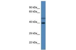 Image no. 1 for anti-Hydroxysteroid Dehydrogenase Like 1 (HSDL1) (C-Term) antibody (ABIN6746873)