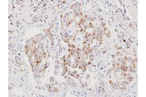 Image no. 1 for anti-Apoptosis-Inducing Factor, Mitochondrion-Associated, 1 (AIFM1) (N-Term) antibody (ABIN2855383)