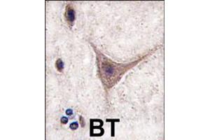 Image no. 2 for anti-Cadherin 10, Type 2 (T2-Cadherin) (CDH10) (AA 495-523), (C-Term) antibody (ABIN5535226)