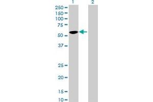 Image no. 1 for anti-UDP Glycosyltransferase 3 Family, Polypeptide A2 (UGT3A2) (AA 1-523) antibody (ABIN531175)