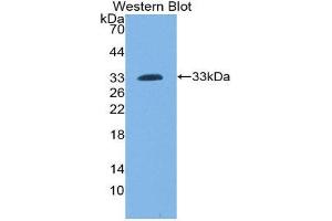 Image no. 1 for anti-Lymphocyte Cytosolic Protein 2 (SH2 Domain Containing Leukocyte Protein of 76kDa) (LCP2) (AA 202-463) antibody (ABIN1859636)