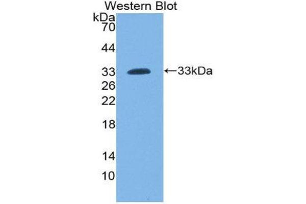 LCP2 antibody  (AA 202-463)
