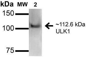 Image no. 2 for anti-Unc-51 Like Kinase 1 (ULK1) (AA 567-577) antibody (Biotin) (ABIN5066148)