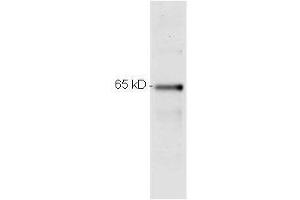 Image no. 6 for anti-Nuclear Factor-kB p65 (NFkBP65) (C-Term) antibody (ABIN964680)