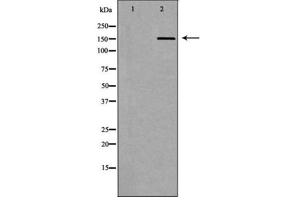 anti-ATP-Binding Cassette, Sub-Family C (CFTR/MRP), Member 5 (ABCC5) (N-Term) antibody