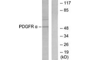 Image no. 2 for anti-Peripherin (PRPH) (AA 421-470) antibody (ABIN1533379)