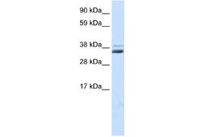 Image no. 1 for anti-Secreted Frizzled-Related Protein 1 (SFRP1) (Middle Region) antibody (ABIN2792235)