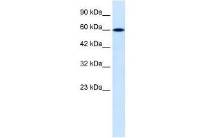 Image no. 1 for anti-Dachshund 2 (DACH2) (C-Term) antibody (ABIN927377)