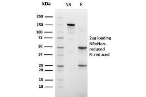 Image no. 1 for anti-Cadherin-16 (CDH16) (AA 371-507) antibody (ABIN6939023)