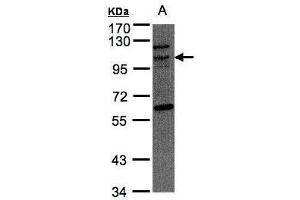 Image no. 1 for anti-TAO Kinase 3 (TAOK3) (Internal Region) antibody (ABIN2855509)