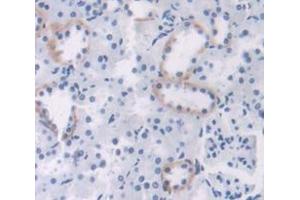 Image no. 2 for anti-Meningioma Expressed Antigen 5 (Hyaluronidase) (MGEA5) (AA 19-222) antibody (ABIN1172151)