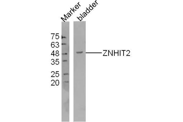 anti-Zinc Finger, HIT-Type Containing 2 (ZNHIT2) (AA 51-150) antibody