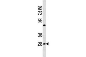 Image no. 4 for anti-Prohibitin (PHB) (AA 92-121) antibody (ABIN3032314)