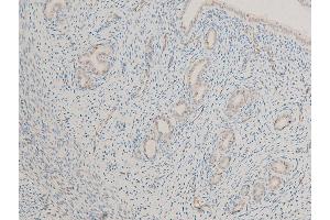 Image no. 10 for anti-Microphthalmia-Associated Transcription Factor (MITF) (pSer180), (pSer73) antibody (ABIN6255037)