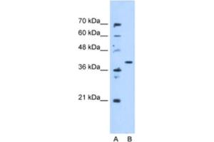 Image no. 1 for anti-Enoyl CoA Hydratase Domain Containing 3 (ECHDC3) antibody (ABIN2463233)