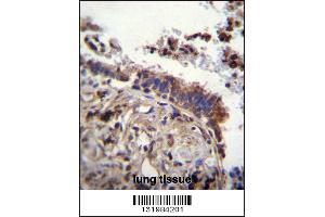 Image no. 1 for anti-tau Tubulin Kinase 2 (TTBK2) (AA 217-245), (N-Term) antibody (ABIN656096)
