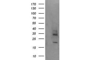 Image no. 5 for anti-Melanoma Antigen Family A, 4 (MAGEA4) antibody (ABIN1499260)