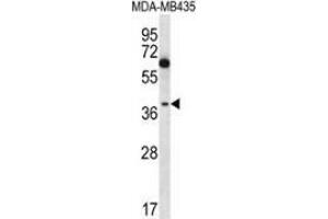 Image no. 3 for anti-Nuclear Factor of kappa Light Polypeptide Gene Enhancer in B-Cells Inhibitor-Like 1 (NFKBIL1) (AA 334-364), (C-Term) antibody (ABIN953696)