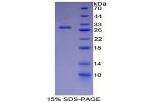 Image no. 1 for Cyclin-Dependent Kinase 9 (CDK9) (AA 104-315) protein (T7 tag,His tag) (ABIN6237945)