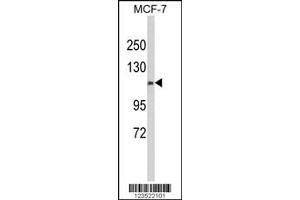 Western Blotting (WB) image for anti-Calponin Homology Domain Containing 2 (CHDC2) antibody (ABIN2158422)