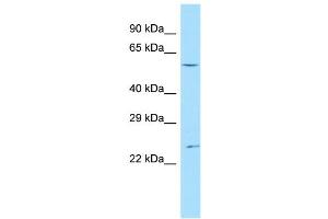 Image no. 1 for anti-Ankyrin Repeat Domain 13C (ANKRD13C) (C-Term) antibody (ABIN2783358)