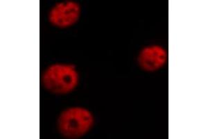 Image no. 2 for anti-GATA Binding Protein 4 (GATA4) (pSer105) antibody (ABIN6256094)