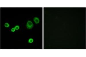 Image no. 2 for anti-Holocytochrome C Synthase (HCCS) (AA 81-130) antibody (ABIN1534309)