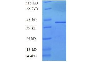 Image no. 1 for Thrombospondin 3 (THBS3) (AA 24-350), (partial) protein (GST tag) (ABIN5710492)