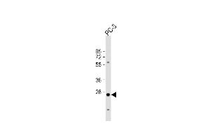 CREM 抗体  (C-Term)