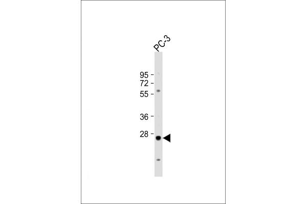 CREM anticorps  (C-Term)