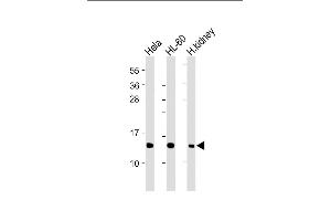 MT-ND4L antibody  (C-Term)