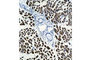 Image no. 3 for anti-Actin, alpha 1, Skeletal Muscle (ACTA1) antibody (ABIN1536597)