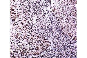 Image no. 8 for anti-V-Myb Myeloblastosis Viral Oncogene Homolog (Avian)-Like 2 (MYBL2) (N-Term) antibody (ABIN3029533)