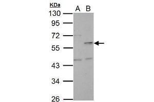 WB Image Sample (30 ug of whole cell lysate) A: HeLa B: HeLa nucleus 10% SDS PAGE antibody diluted at 1:5000