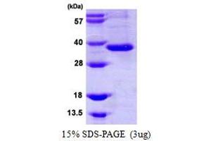 Image no. 1 for Intelectin 1 (Galactofuranose Binding) (ITLN1) (AA 17-313) protein (ABIN667496)