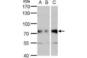 WB Image DMPK antibody detects DMPK protein by western blot analysis.