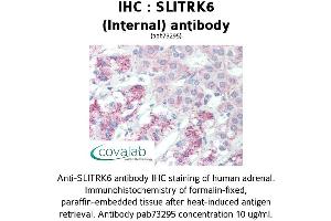 Image no. 2 for anti-SLIT and NTRK-Like Family, Member 6 (SLITRK6) (Internal Region) antibody (ABIN1739444)