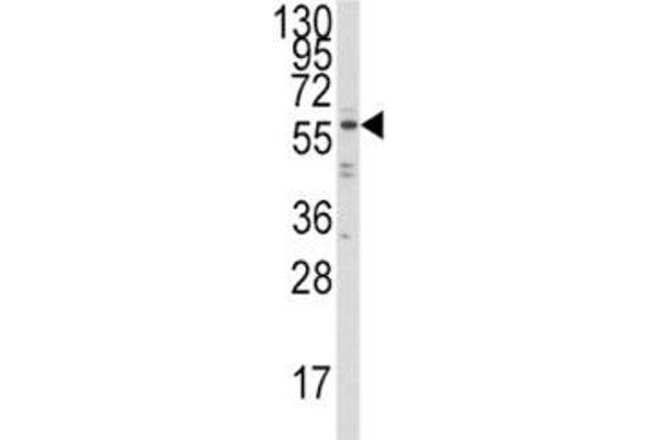 IRF5 Antikörper  (AA 81-108)