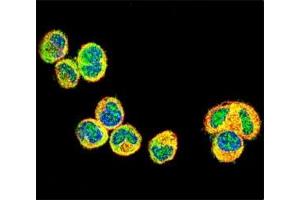 Image no. 5 for anti-V-Akt Murine Thymoma Viral Oncogene Homolog 1 (AKT1) (AA 115-144) antibody (ABIN3029459)