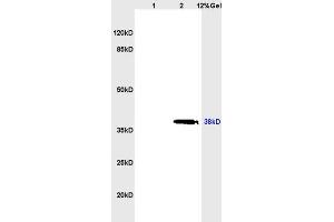 Image no. 6 for anti-Selectin L (SELL) (AA 301-372) antibody (ABIN736716)
