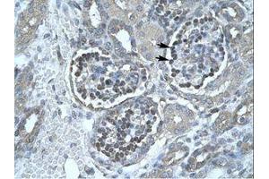Image no. 2 for anti-Pancreatic Lipase (PNLIP) (AA 325-374) antibody (ABIN202587)