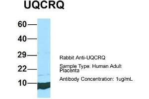 Image no. 1 for anti-Ubiquinol-Cytochrome C Reductase, Complex III Subunit VII, 9.5kDa (UQCRQ) (Middle Region) antibody (ABIN2790714)