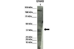 Image no. 3 for anti-GNAS Complex Locus (GNAS) (N-Term) antibody (ABIN2775542)